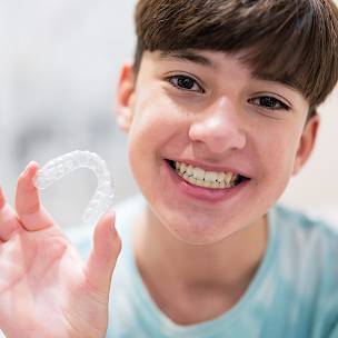 clear aligners