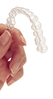 invisible braces
